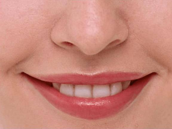 吃瓜之后唇边痒,揭秘背后的健康密码