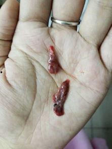 做完流产可以吃瓜吗,这些食物禁忌你了解吗？